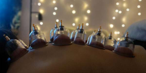 Cupping therapy